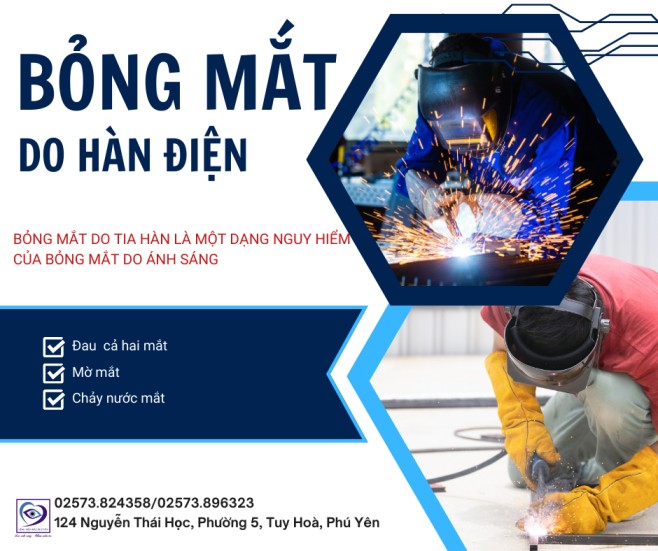 Bỏng hàn